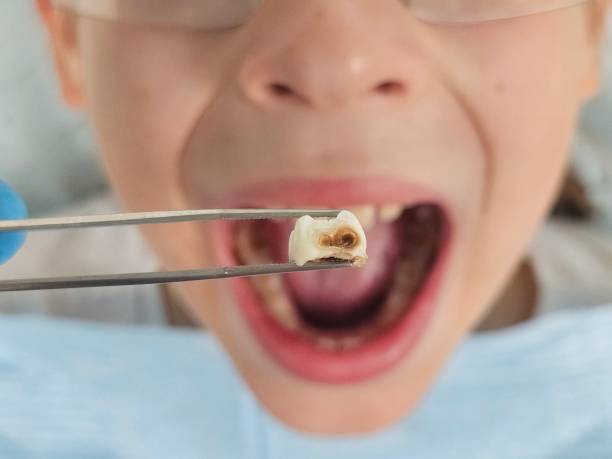 Best Urgent Tooth Repair  in Norridge, IL