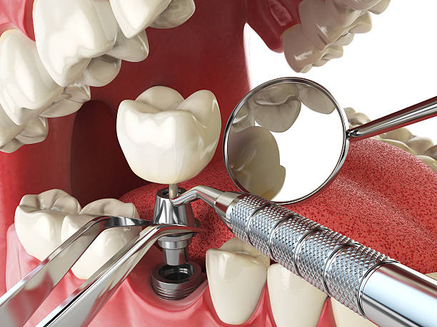 Best Knocked-Out Tooth Emergency  in Norridge, IL
